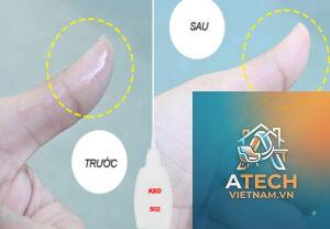 cách làm sạch keo 502 trên da
