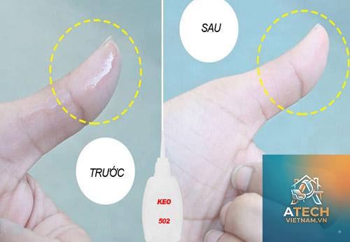 cách làm sạch keo 502 trên da