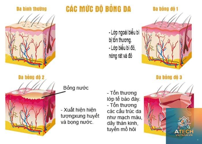 cách phòng ngừa bỏng khi hàn - Hình 2