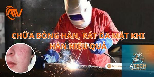 cách phòng ngừa bỏng khi hàn - Hình 5