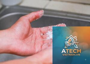 cách rửa keo 502 dính vào tay