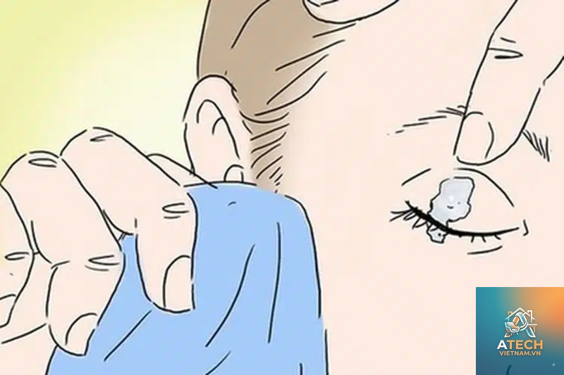 cách xử lý keo 502 dính vào mắt - Hình 3